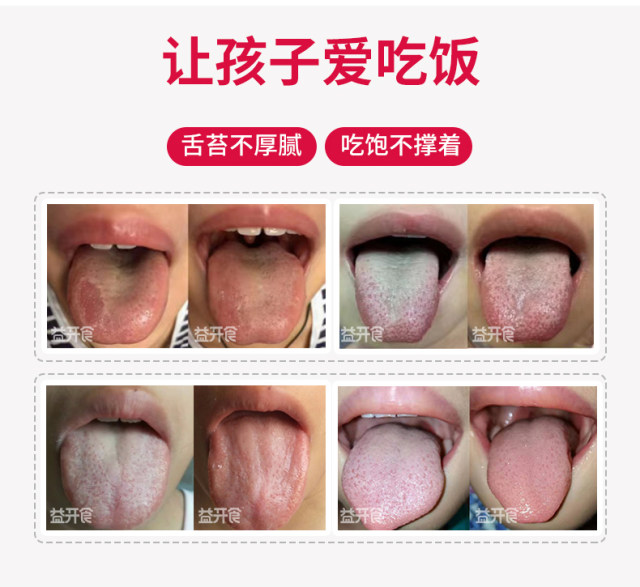 益開(kāi)食雞內(nèi)金山楂六物膏 (2).jpg